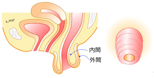 図1　直腸脱の状態